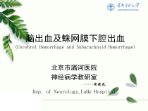 课件脑出血和蛛网膜下腔出血