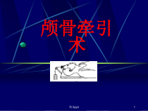 颅骨牵引术课件