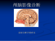 颅脑影像神内课件