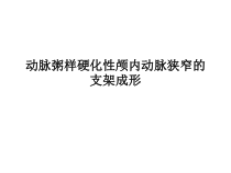 颅内动脉支架课件