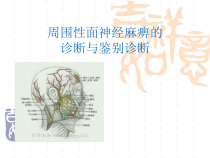 面神经麻痹的诊断与鉴别诊断-课件
