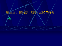 脑出血脑梗塞脑软化灶CT病例课件