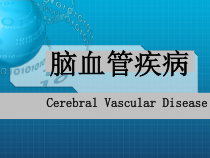 脑血管病课件