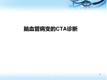 脑血管病变的CTA诊断课件