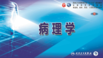 十六章-神经系统疾病课件