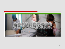 手足口病神经系表现课件