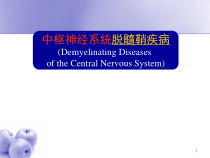 脱髓鞘疾病课件_2