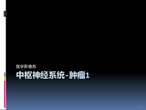 影像诊断中枢神经系统肿瘤课件