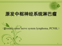 原发性中枢神经系统淋巴瘤课件_2