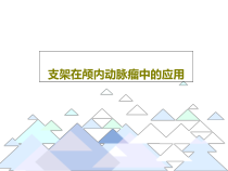 支架在颅内动脉瘤中的应用共55张课件
