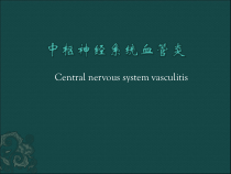 中枢神经系统血管炎课件_2