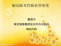 中枢神经系统血管炎课件