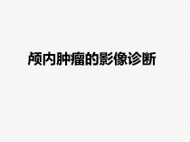 中枢神经系统-影像3课件