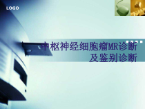 中枢神经细胞瘤MR诊断及鉴别诊断课件