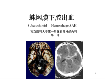 蛛网膜下腔出血教案-课件