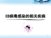 EB病毒感染的特殊表现医学课件