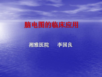 EEG的临床应用新版-课件