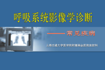医学呼吸系统影像学诊断常见疾病课件