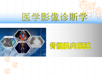 医学基本病变影像学表现教学课件