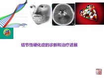 医学课件结节性硬化症的诊断和治疗进展
