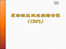 CRPS的诊断和治疗课件