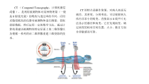CT技术在医学领域的应用课件