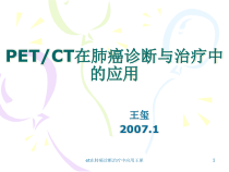 et在肺癌诊断治疗中应用课件