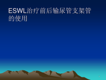 ESWL治疗前后输尿管支架管使用课件