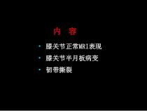 基础医学半月板和韧带核磁共振诊断课件
