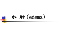 医学水肿讲解教学课件