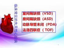 常见的几种先心病医学课件