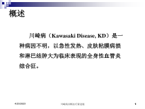 川崎病诊断治疗新进展培训课件