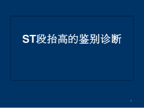 ST段抬高的鉴别诊断A医学课件