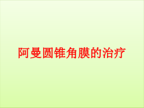 阿曼圆锥角膜的治疗课件