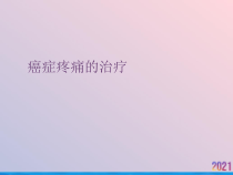 癌症疼痛的治疗2021推荐课件