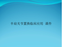 半肩关节置换临床应用-课件