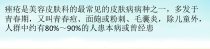 不同部位青春痘有不同的病因医学课件