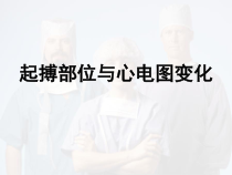 不同起搏部位心电图医学课件