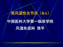 常见疾病-病因和治疗方法类风湿性关节炎RA课件