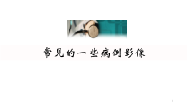 常见的口腔病例影像医学课件