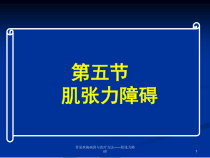 常见疾病病因与治疗方法肌张力障碍课件