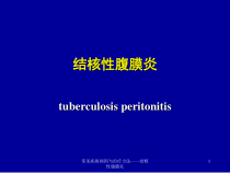 常见疾病病因与治疗方法结核性腹膜炎课件