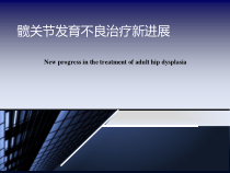 成人髋关节发育不良治疗新进展课件