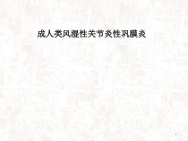成人类风湿性关节炎性巩膜炎医学课件