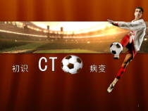 初识CTO病变医学课件