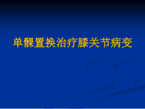 单髁置换治疗膝关节病变课件