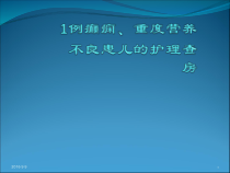 癫痫及营养不良患儿的病情观察与护理医学课件