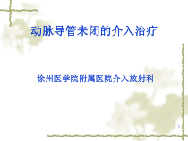 动脉导管未闭的介入治疗课件
