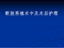断-指-再-植医学课件