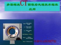 多层螺旋CT图像后处理技术临床应用课件